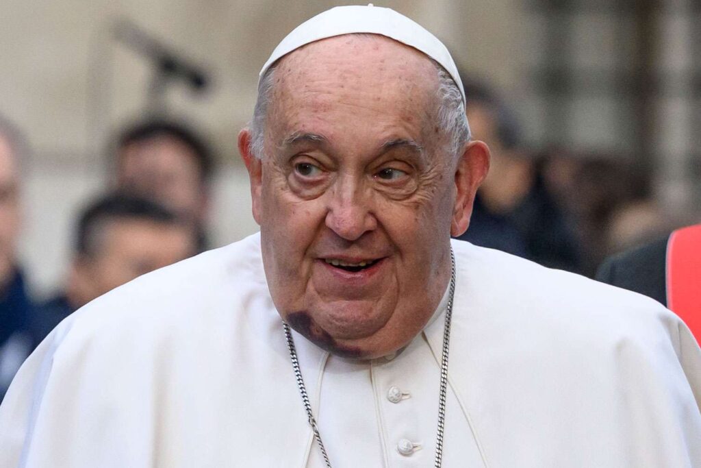 Pope Francis, 87, Appears at Ceremony with Bruise on His Chin Following Fall